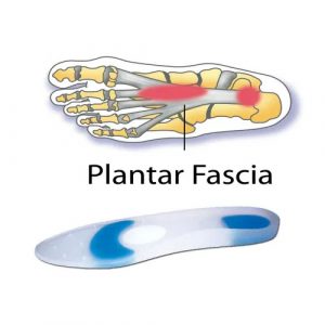 ضبان طبي لضمان راحة القدم – RAYAT Silicone Insole